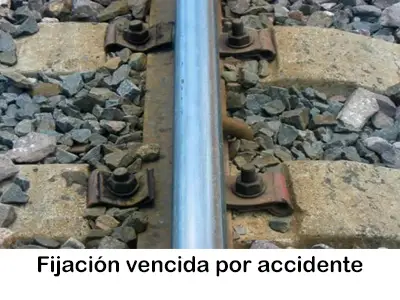 auscultacion gemetrica mexico defecto de fijacion vencida global strix
